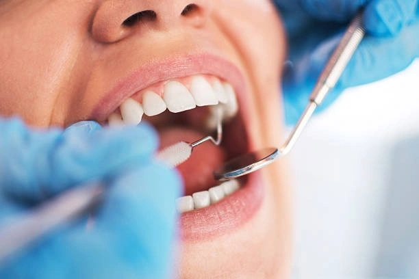 dental-checkups-ottawa-ontario