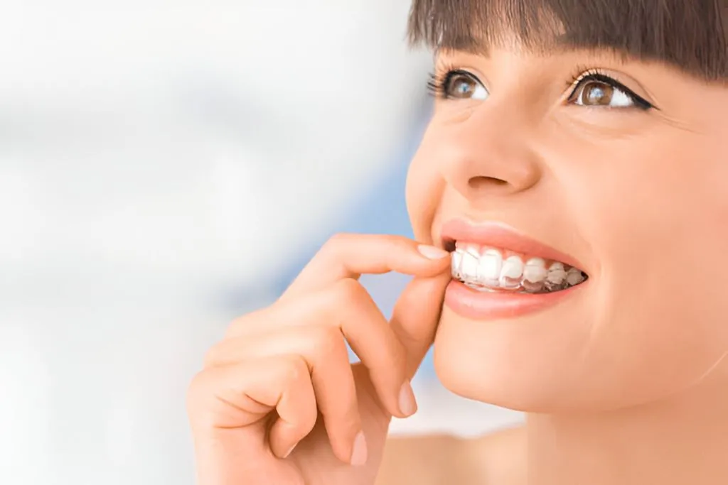 invisalign-ottawa