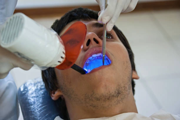 root-canal-treatment-ottawa-ontario