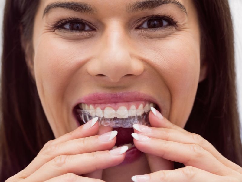 what happens if i don't wear invisalign enough